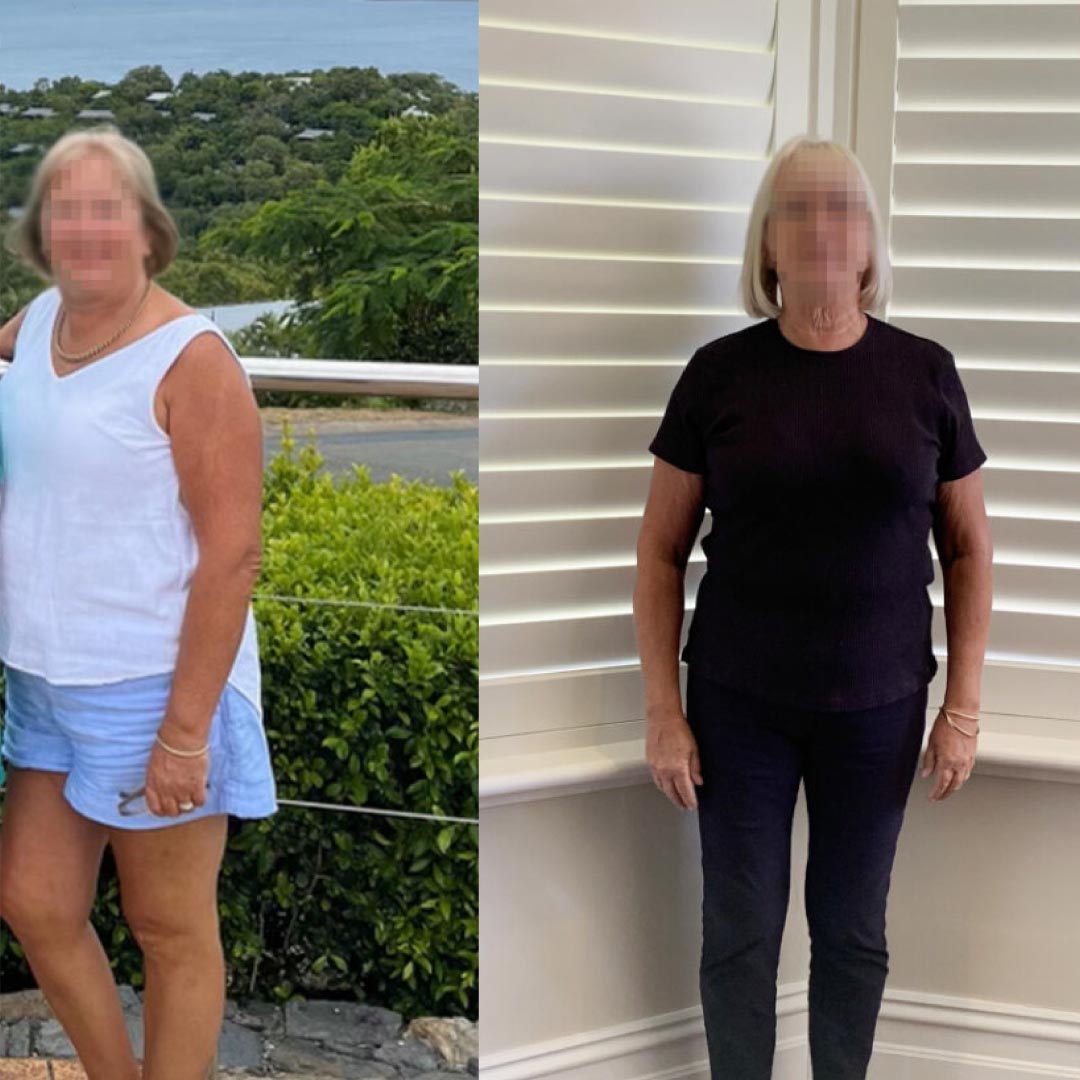 Before and after, lady results on shakes.