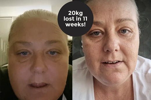 Looming Surgery, with Urgent Weight Loss Needed